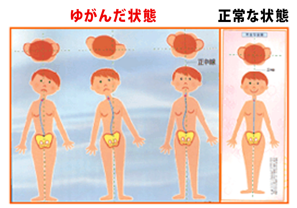 身体や骨盤のゆがみ