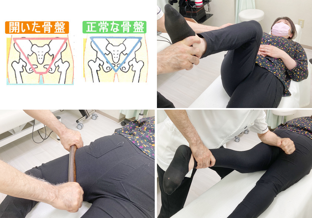 骨盤小尻引き締め整体